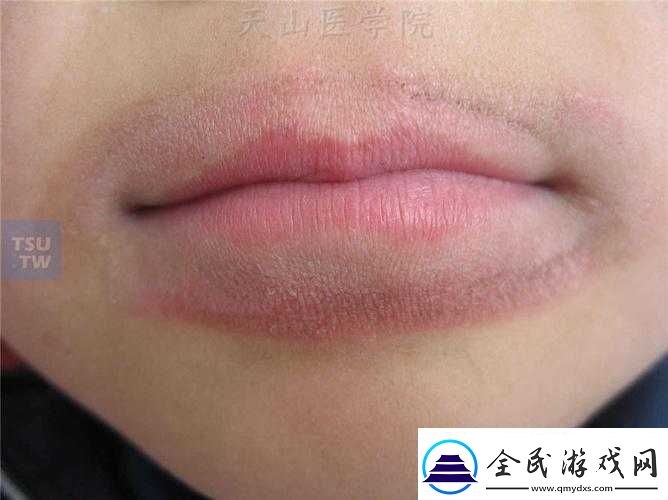 舌頭舔到硬物疼痛