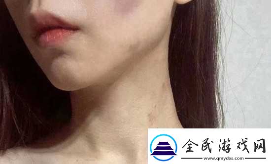 紅雅典娜LIYA死了嗎傳身體四分五裂是真的嗎